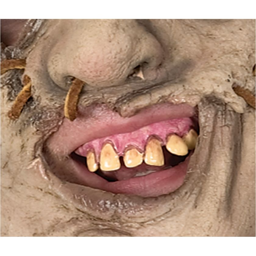 TEXAS CHAINSAW MASSACRE LEATHERFACE PROSTHETIC TEETH  